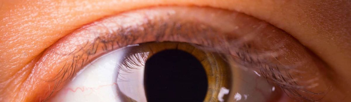 What Prescribed and Nonprescribed Drugs Cause Dilated Pupils?